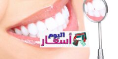 سعر تنظيف الأسنان في السعودية 1444 | سعر تنظيف اللثة